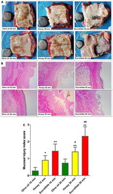 Electric Insulating Irrigations Mitigates Esophageal Injury Caused by Button Battery Ingestion